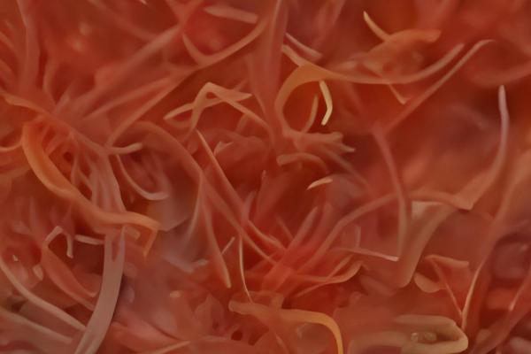 红线虫会不会钻进人体，不进入人体但容易携带细菌和寄生虫