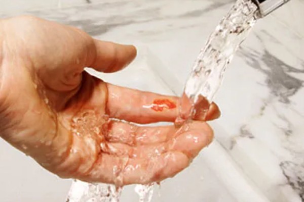 被一只马蜂蛰了有什么后果，被大型马蜂蛰到会很危险