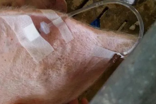 小猪腹泻的原因，包含病理性和生理性腹泻等
