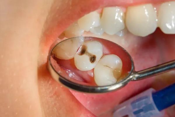 提子一天吃多少合适,成年人每天以150-200g为宜