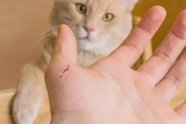 被猫抓伤出血要注射吗，如果抓伤严重需要去医院处理