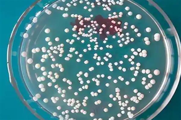 酵母菌怎么生殖,有芽殖、裂殖等4种方式