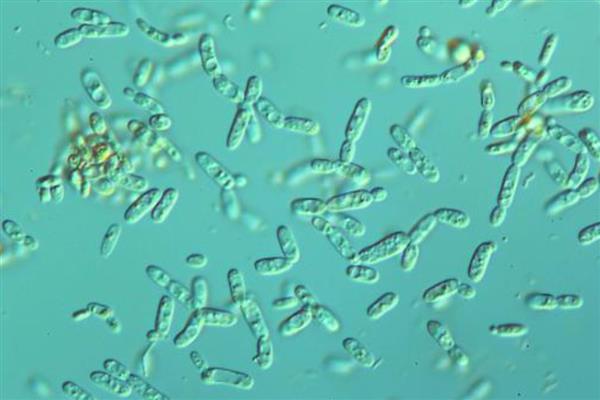 酵母菌怎么生殖,有芽殖、裂殖等4种方式