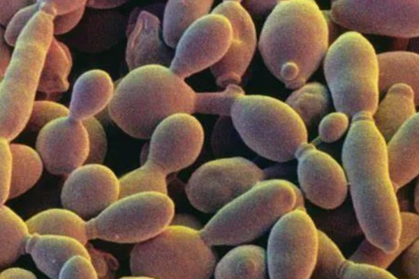 酵母菌怎么繁殖，分为有性繁殖、无性繁殖