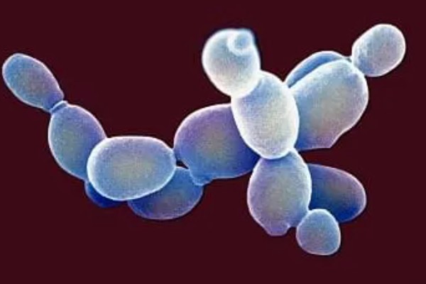 酵母菌怎么繁殖，分为有性繁殖、无性繁殖