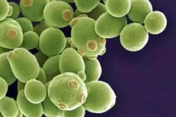 酵母菌怎么繁殖，分为有性繁殖、无性繁殖