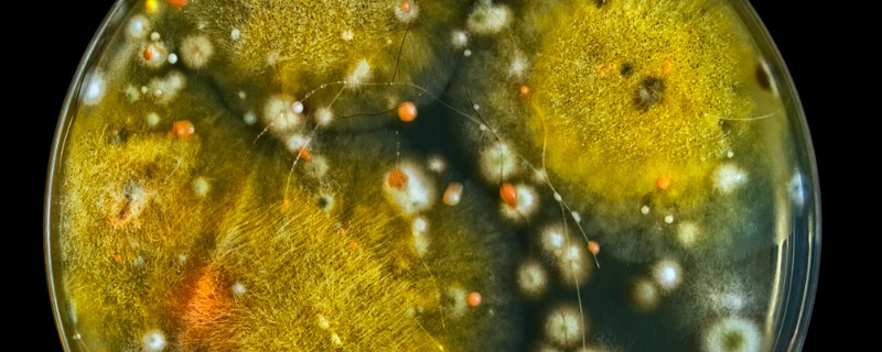 酵母菌怎么繁殖，分为有性繁殖、无性繁殖